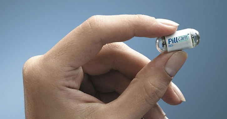 İngiltere’den kanser için “yutulabilir kamera” mucizesi