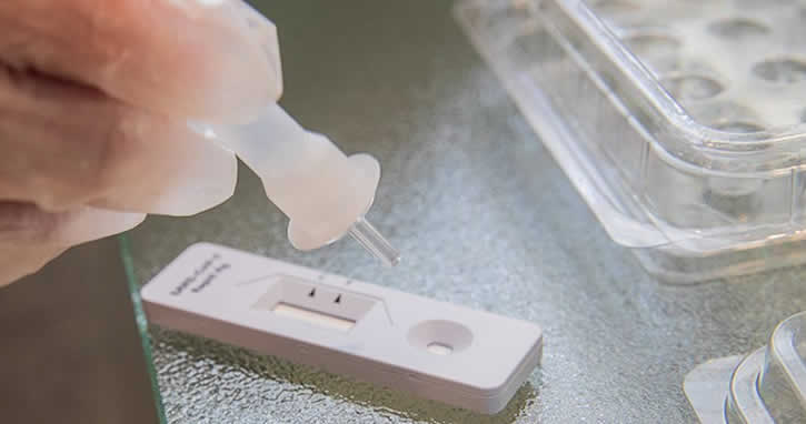 20 saniyede sonuç veren koronavirüs testi onaylandı