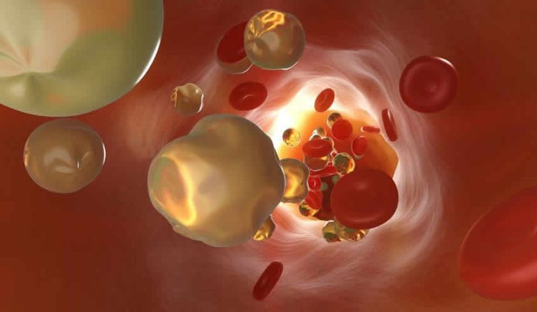 NHS, hayat kurtaran aşıyı kullanıma sunmaya hazırlanıyor
