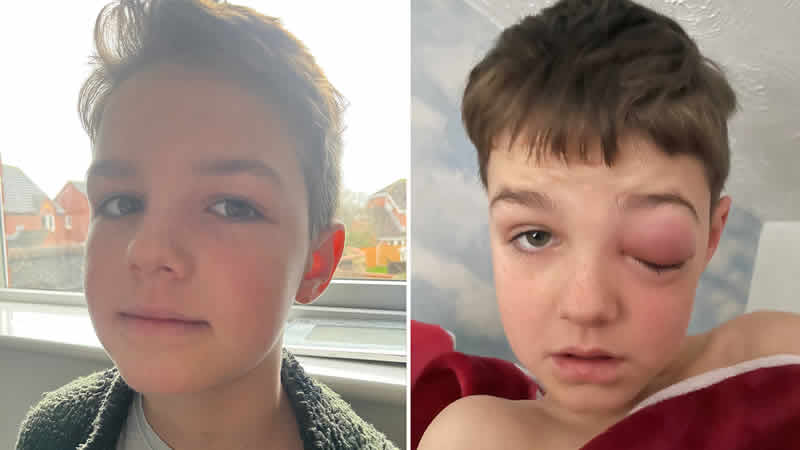 9 yaşındaki çocuk korona virüs yüzünden kabusu yaşadı