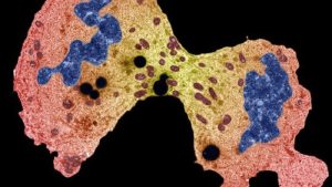 İngiltere’de yapılan dev DNA araştırmasıyla kanserde yeni ipuçları ortaya çıktı