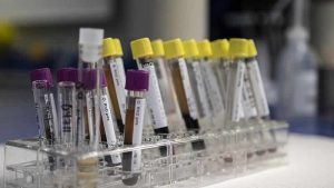 İngiltere’deki gizemli hepatit virüsü Avrupa ve ABD’de yayılmaya başladı