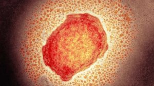 Maymun çiçeği (monkeypox) virüsünün cinsel sağlık üzerindeki etkisi endişeye neden oldu