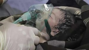 İlk olarak İngiltere’de ortaya çıkan gizemli hastalık Meksika’ya sıçradı