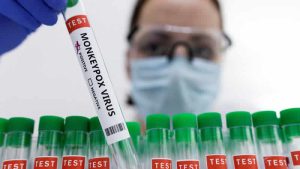 Oxford Üniversitesi maymun çiçeği tedavisi üzerine çalışmaya başladı