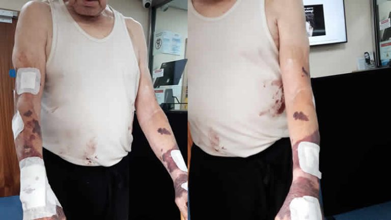 İngiltere’de polis ‘yanlışlıkla’ 81 yaşındaki adamın evine baskın düzenleyip darp etti