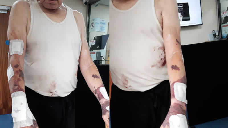 İngiltere’de polis ‘yanlışlıkla’ 81 yaşındaki adamın evine baskın düzenleyip darp etti