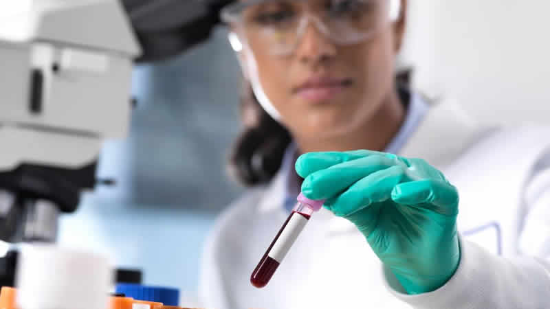 İngiltere’de semptomlar ortaya çıkmadan kanser tespiti yapılabilecek