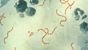 İngiltere’de Strep A’ya bağlı ölümler 122’ye ulaştı