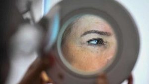 İngiltere’de cilt kanseri vakaları tarihin en yüksek seviyesinde