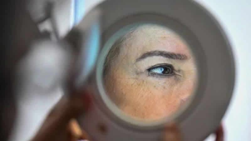 İngiltere’de cilt kanseri vakaları tarihin en yüksek seviyesinde