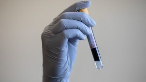 Hükümet, 12 Yaygın Kanser Türünü Tespit Eden Kan Testini Finanse Edecek