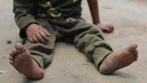 İngiltere’ye Gazzeli Çocukların Tedavisini Reddettiği İçin Dava Açıldı