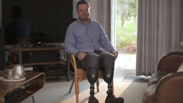 İngiltere’de Akılalmaz Olay: Cerrah Kendi Bacaklarını Kesti, Sigortayı Dolandırdı