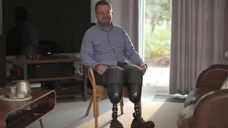 İngiltere’de Akılalmaz Olay: Cerrah Kendi Bacaklarını Kesti, Sigortayı Dolandırdı